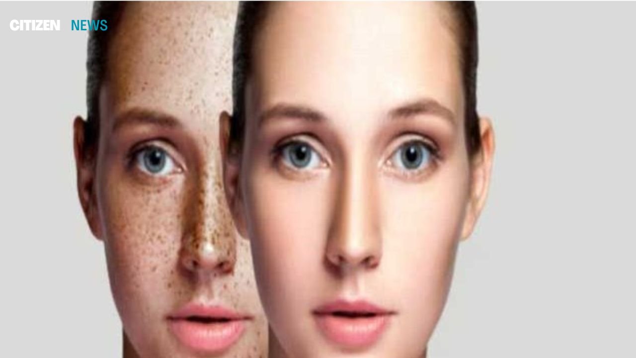 facial kit : चेहरे के दाग-धब्बे खत्म नहीं हो रहे तो लगाएं होममेड विटामिन सी फेस पैक...
